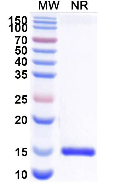 SDS-PAGE for Anti-Human CD112/Nectin-2/PVRL2 Nanobody (SAA2117).