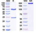 SDS-PAGE for Anti-Human CD112/Nectin-2/PVRL2 Antibody (SAA2115)
