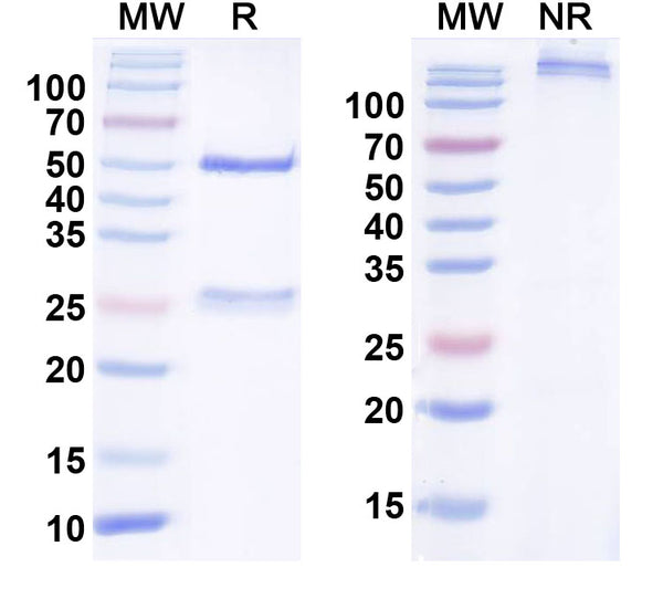 SDS-PAGE for Anti-FGF13/FHF2 Antibody (N225A/10)