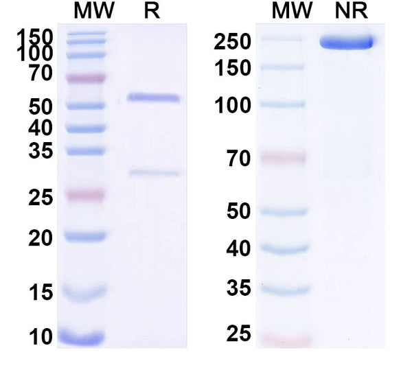 SDS-PAGE for Anti-Human ADAM28 Antibody (SAA1723)