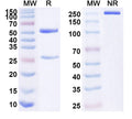 SDS-PAGE for Anti-Human IL20RB Antibody (SAA1601)