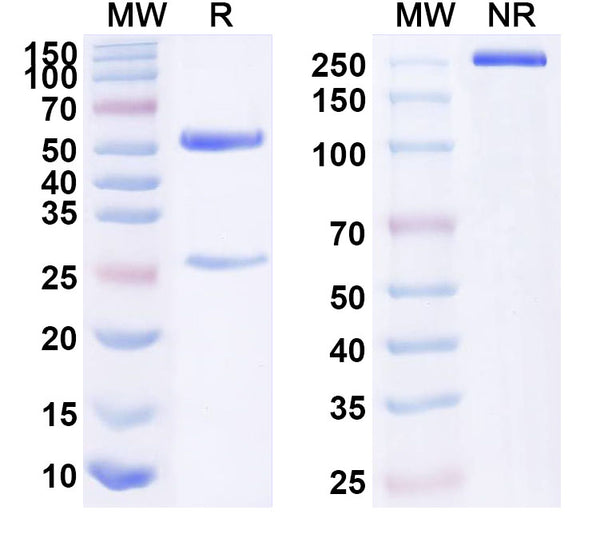 SDS-PAGE for Anti-Human IL20RB Antibody (SAA1601)