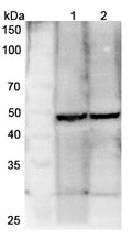 Western blot analysis was performed using anti-TP63 polyclonal antibody at 1μg/ml on various samples.
Lane 1: Mouse brain lysate
Lane 2: Rat brain lysate