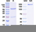 SDS-PAGE for Anti-ATAT1 Antibody (N347/70)