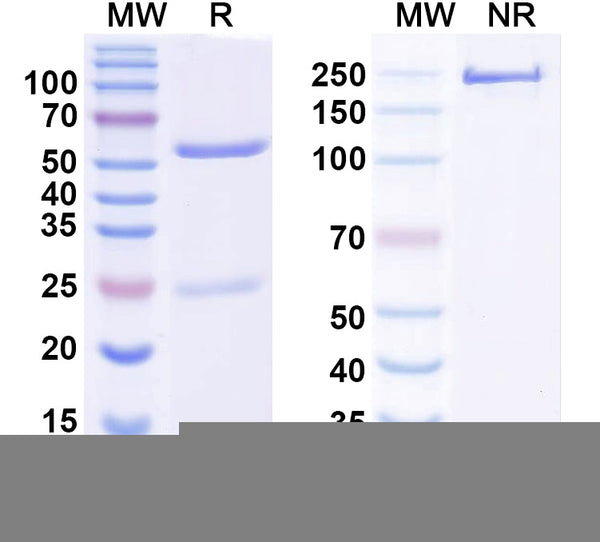 SDS-PAGE for Anti-ATAT1 Antibody (N347/70)