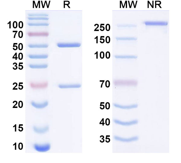 SDS-PAGE for Anti-Human ATAT1 Monoclonal Antibody (1A144)