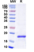 Recombinant Human LAMP3 Protein, N-His