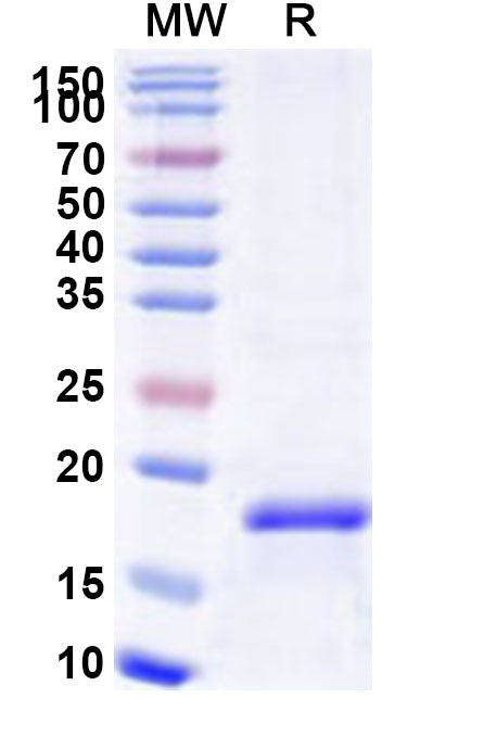 Recombinant Human LAMP3 Protein, N-His