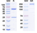 Anti-Human Frizzled-10 Reference Antibody (Tabituximab) – Figure 1 of 2
