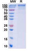 Recombinant Human CD244 Protein, C-Fc