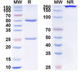 Anti-Human R-Spondin 3 Reference Antibody (Rosmantuzumab) – Figure 1 of 1