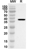 Western blot analysis was performed using anti-Human AATF polyclonal antibody at 1ug/mL on recombinant Human AATF (Catalog No. HV515022).