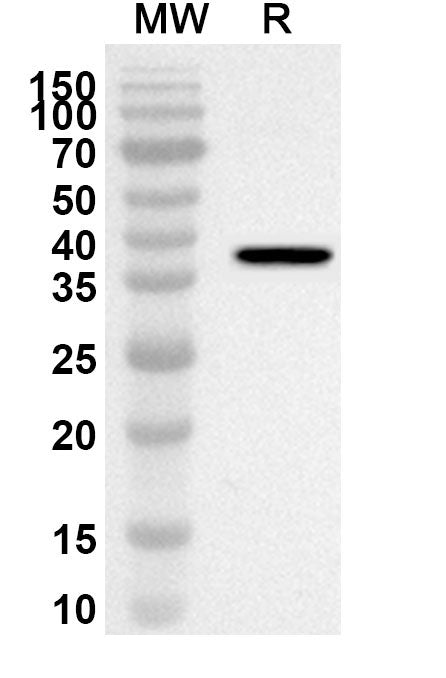 Western blot analysis was performed using anti-Human AATF polyclonal antibody at 1ug/mL on recombinant Human AATF (Catalog No. HV515022).