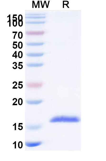 SDS-PAGE for Anti-Human CPB2 Nanobody (SAA1167)