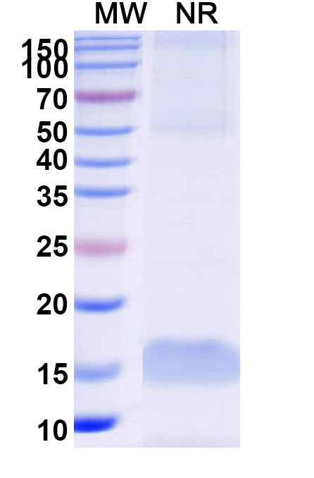 SDS-PAGE for Anti-Human CPB2 Nanobody (SAA1017)