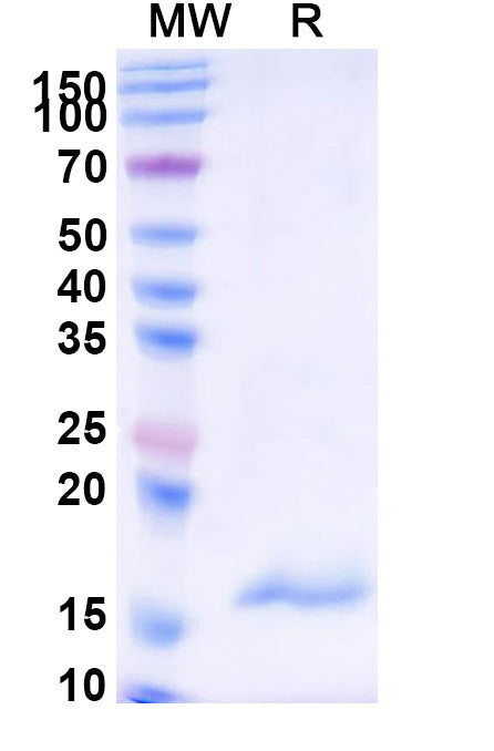 SDS-PAGE for Anti-Human CPB2 Nanobody (SAA1018)