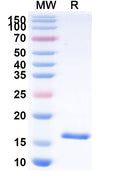 SDS-PAGE for Anti-Human CPB2 Nanobody (SAA1041)