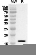Western blot analysis was performed using anti-XYLT1 polyclonal antibody at 1ug/mL on recombinant XYLT1 (Catalog No. HV521012).