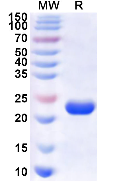 Recombinant Human LAMC3 Protein, N-GST