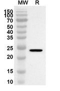 Western blot analysis was performed using anti-IL1RAP polyclonal antibody at 1ug/mL on recombinant IL1RAP (Catalog No. HV556012).
