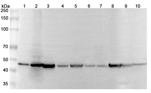 Western blot analysis was performed using anti-GDA polyclonal antibody at 1μg/ml on various samples.
Lane 1: Hela cell lysate
Lane 2: SKOV3 cell lysate
Lane 3: NICH460 cell lysate
Lane 4: HepG2 cell lysate
Lane 5: Mouse brain lysate
Lane 6: Mouse liver lysate
Lane 7: Mouse kidney lysate
Lane 8: Rat brain lysate
Lane 9: Rat liver lysate
Lane 10: Rat kidney lysate