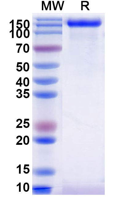 Recombinant Human MUC16/CA125 Protein, C-His