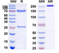 SDS-PAGE for Anti-Human MUC16/CA125 Antibody (3D5)
