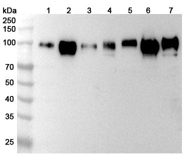 Western blot analysis was performed using anti-CD276  polyclonal antibody at 1ug/mL  on various samples.
Lane 1: Hela cell lysate
Lane 2: Lncap cell lysate
Lane 3: U2OS cell lysate
Lane 4: A431 cell lysate
Lane 5: HepG2 cell lysate
Lane 6: 293T cell lysate
Lane 7: MCF-7 cell lysate
