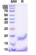 SDS-PAGE for Anti-Human CD276/B7-H3 Nanobody (SAA2193)