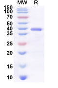 Recombinant Human FCRL4 Protein, N-His