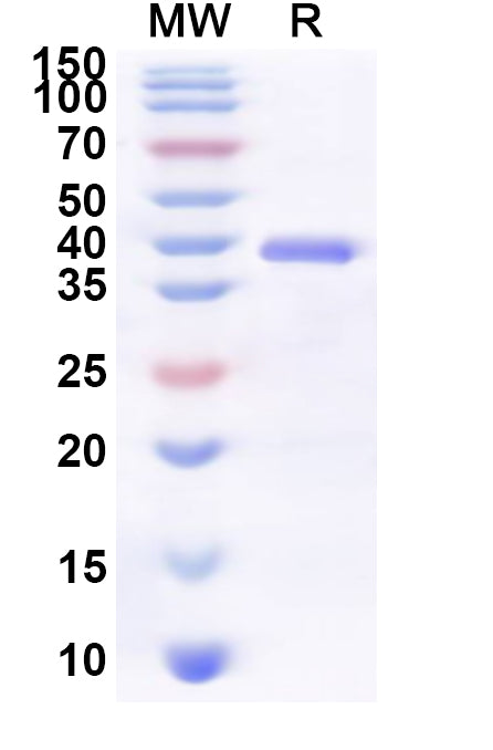 Recombinant Human FCRL4 Protein, N-His