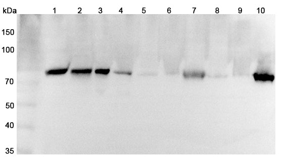 Western blot analysis was performed using anti-SEMA3C polyclonal antibody at 1μg/ml on various samples.
Lane 1: Raw264.7 cell lysate
Lane 2: MCF7 cell lysate
Lane 3: PC12 cell lysate
Lane 4: Jurkat cell lysate
Lane 5: Mouse lung lysate
Lane 6: Mouse small intestine lysate
Lane 7: Mouse heart lysate
Lane 8: Rat lung lysate
Lane 9: Rat small intestine lysate
Lane 10: Rat heart lysate