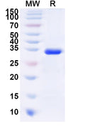 Recombinant Human ADIPOR1 Protein, N-His-KSI