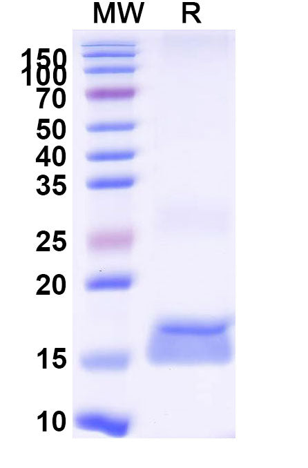 SDS-PAGE for Anti-Human AKT3 Nanobody (SAA1232)