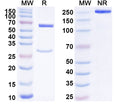 SDS-PAGE for Anti-Human CD201/PROCR/EPCR Antibody (SAA1813)