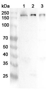 Western blot analysis was performed using anti-TJP2 polyclonal antibody at 1ug/mL on various samples.
Lane 1: Mosue brain lysate
Lane 2: Mouse heart lysate
Lane 3: Rat brain lysate