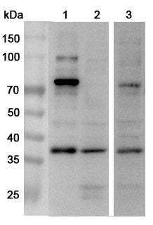 Western blot analysis was performed using anti-APOL2 polyclonal antibody at 1μg/ml on various samples.
Lane 1: Hela cell lysate
Lane 2: A549 cell lysate
Lane 3: HepG2 cell lysate