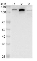 Western blot analysis was performed using anti-PITRM1 polyclonal antibody at 1μg/ml on various samples.
Lane 1: MCF7 cell lysate
Lane 2: 293T cell lysate
Lane 3: Mouse kidney lysate