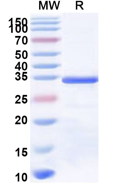 Recombinant Human FCRL5 Protein, N-His