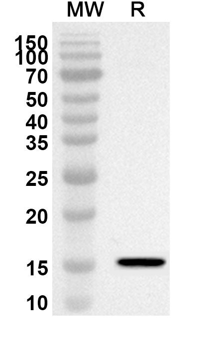 Western blot analysis was performed using anti-CD278/ICOS polyclonal antibody at 1ug/mL on recombinant CD278/ICOS (Catalog No. HV702012).