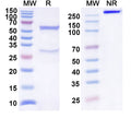 Anti-Human VTCN1/B7-H4 Reference Antibody (NC762) – Figure 1 of 1