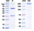 Anti-Human B7-H4 Reference Antibody (Felmetatug, Vedotin ADC) – Figure 1 of 1