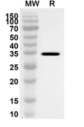 Western blot analysis was performed using anti-SLC17A5 polyclonal antibody at 1ug/mL on recombinant SLC17A5 (Catalog No. HV722022).