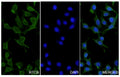 A549 cells were fixed with 4% paraformaldehyde for 20 minutes, followed by blocking with 5% goat serum for 1 hour. The cells were then incubated with a primary antibody targeting RTCB (HV728014) at a concentration of 31.5 ug/ml overnight at 4°C. Afterward, the cells were incubated with a secondary antibody, Goat Anti-Rabbit IgG (Alexa Fluor-488) for 50 minutes at room temperature. The localization of RTCB was visualized (shown in green), and nuclear DNA was stained with DAPI (shown in blue).