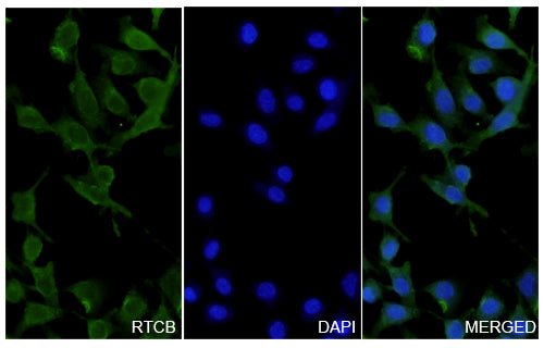 A549 cells were fixed with 4% paraformaldehyde for 20 minutes, followed by blocking with 5% goat serum for 1 hour. The cells were then incubated with a primary antibody targeting RTCB (HV728014) at a concentration of 31.5 ug/ml overnight at 4°C. Afterward, the cells were incubated with a secondary antibody, Goat Anti-Rabbit IgG (Alexa Fluor-488) for 50 minutes at room temperature. The localization of RTCB was visualized (shown in green), and nuclear DNA was stained with DAPI (shown in blue).