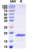 Recombinant Human DNMT3B Protein, N-His