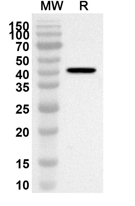Western blot analysis was performed using anti-AZIN2 polyclonal antibody at 1ug/mL on recombinant AZIN2 (Catalog No. HV753012).