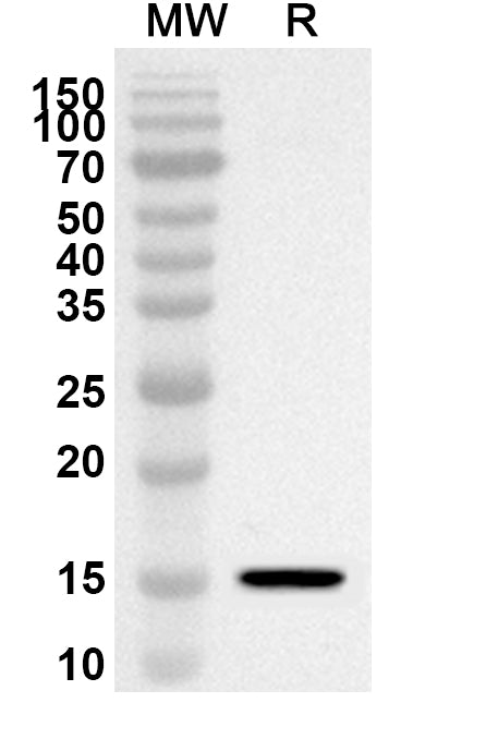 Western blot analysis was performed using anti-SLC30A8 polyclonal antibody at 1ug/mL on recombinant SLC30A8 (Catalog No. HV761012).