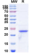 Recombinant Human LAIR1 Protein, N-His