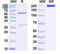 SDS-PAGE for Anti-Human LRRC15/LIB Antibody (SAA1761)
